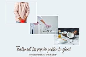 LES PAPULES PERLEES DU GLAND